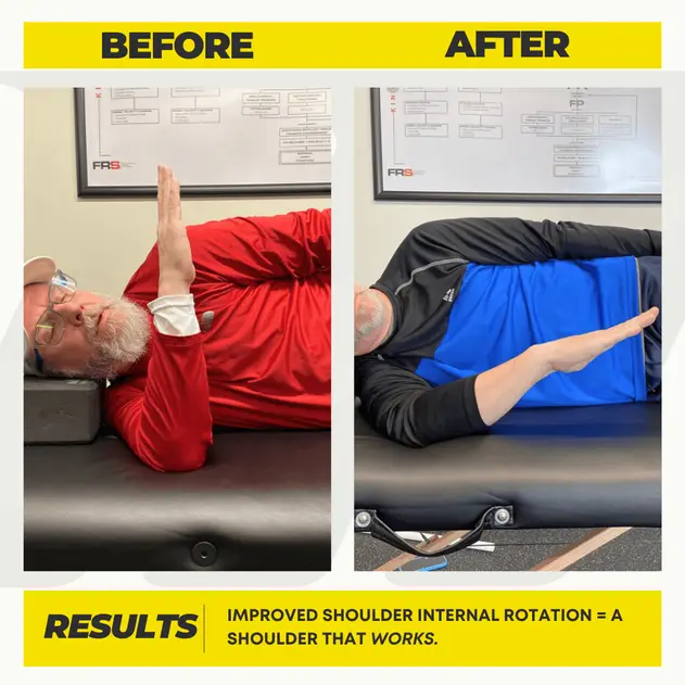 Jay's before and after showing increased shoulder range of motion and less pain through FRC at Motive Training