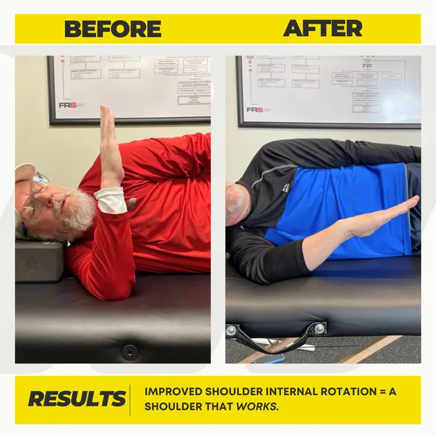 Jay's before and after showing increased shoulder range of motion and less pain through FRC at Motive Training