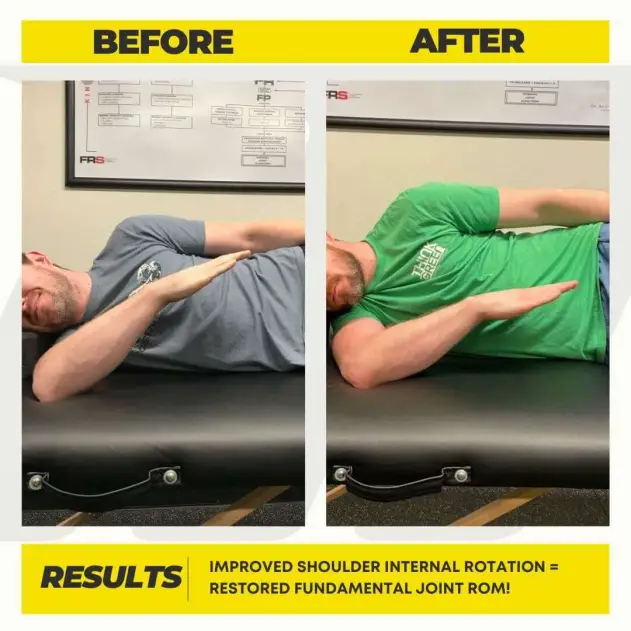 Bryan's before and after showing increased range of motion and less pain through FRC at Motive Training