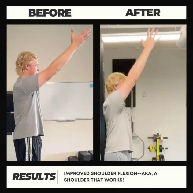 Eric's before and after showing increased range of motion and less pain through FRC at Motive Training